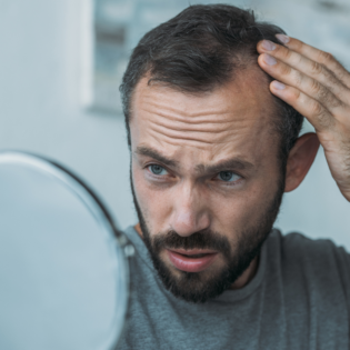 best spray for hair loss
