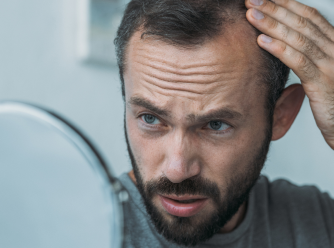 best spray for hair loss