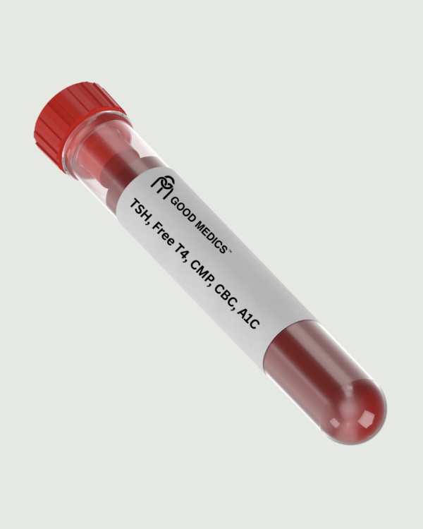 Lab tube labeled for weight loss labs including glucose, insulin, thyroid, and hormone testing