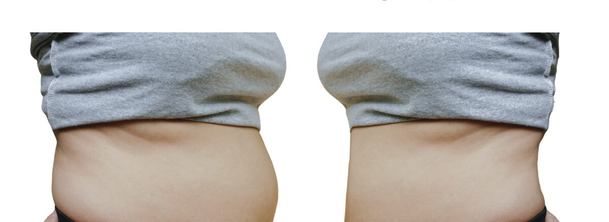 Virtual Weight Loss Program